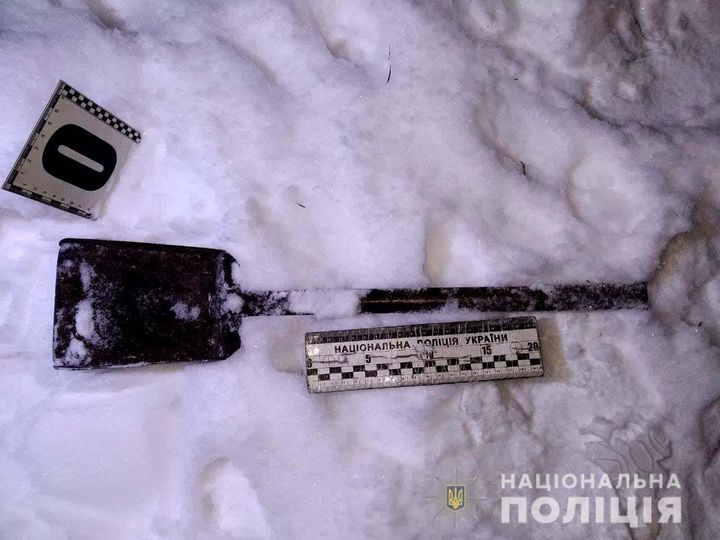 На Рівненщині 48-річна жінка через сварку з чоловіком частково втратила зір