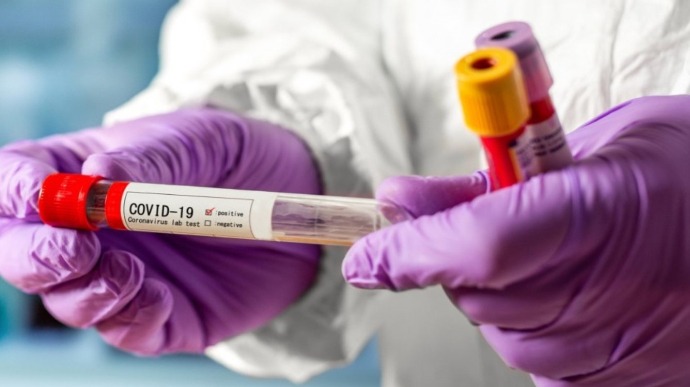На Рівненщині упродовж доби зафіксовано 104 нових випадки COVID-19