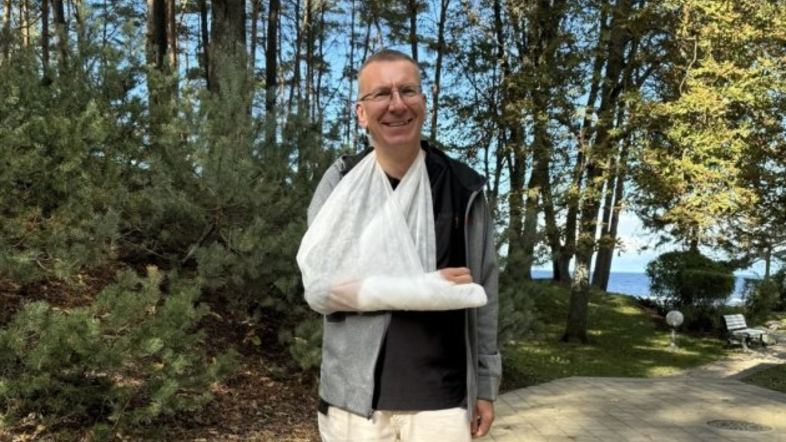 Президент Латвії травмував руку, впавши з велосипеда