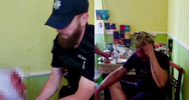 У Рівному чоловік під час бійки розбив голову сусіду