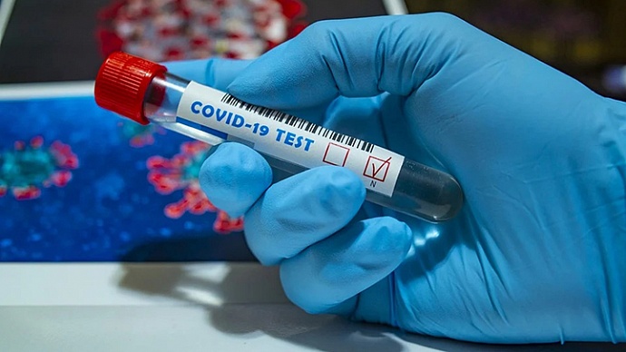 За минулу добу на Рівненщині зареєстровано 809 хворих з COVID-19
