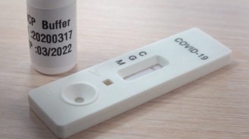 Сімейні лікарі отримають експрес-тестів на антиген