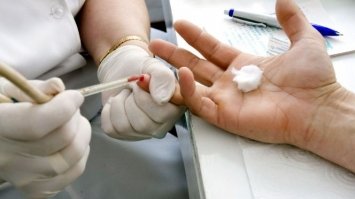 Сьогодні у Рівному безкоштовно перевірятимуть на гепатит С