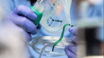 Уряд виділив Рівненщині 20 млн грн на закупівлю кисневих концентраторів.