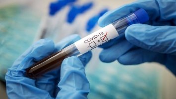 За минулу добу в області 144 хворих на Covid-19, майже усі - з Рівного